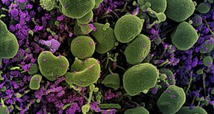 Hình ảnh quét qua kính hiển vi điện tử cho thấy tế bào (màu xanh) bị virus SARS-COV-2 (màu tím) xâm nhập, lấy từ mẫu bệnh phẩm của bệnh nhân COVID-19 tại Viện Nghiên cứu Dị ứng và Bệnh Truyền nhiễm Quốc gia ở Fort Detrick, Maryland, Mỹ.